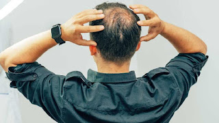 Hair Thinning: শরীরে কোন কোন রোগ বাসা বাঁধলে চুল পড়ার সমস্যা বেড়ে যায়
